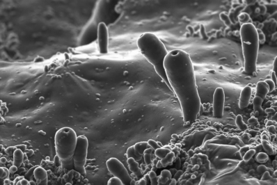 The microscopic “protocells” observed in the experiment carried out by Juan Manuel García Ruiz's team. Credits: Christian Jenewein y Alicia Rivera. Source: ElPais.com