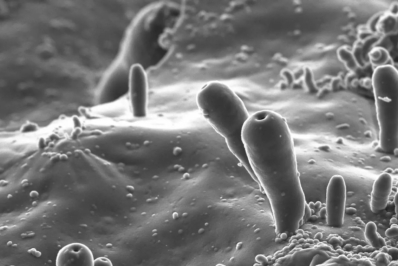 Imágenes de microscopía de las protocélulas sintetizadas en laboratorio. / CD. Fuende: Diario de Sevilla-